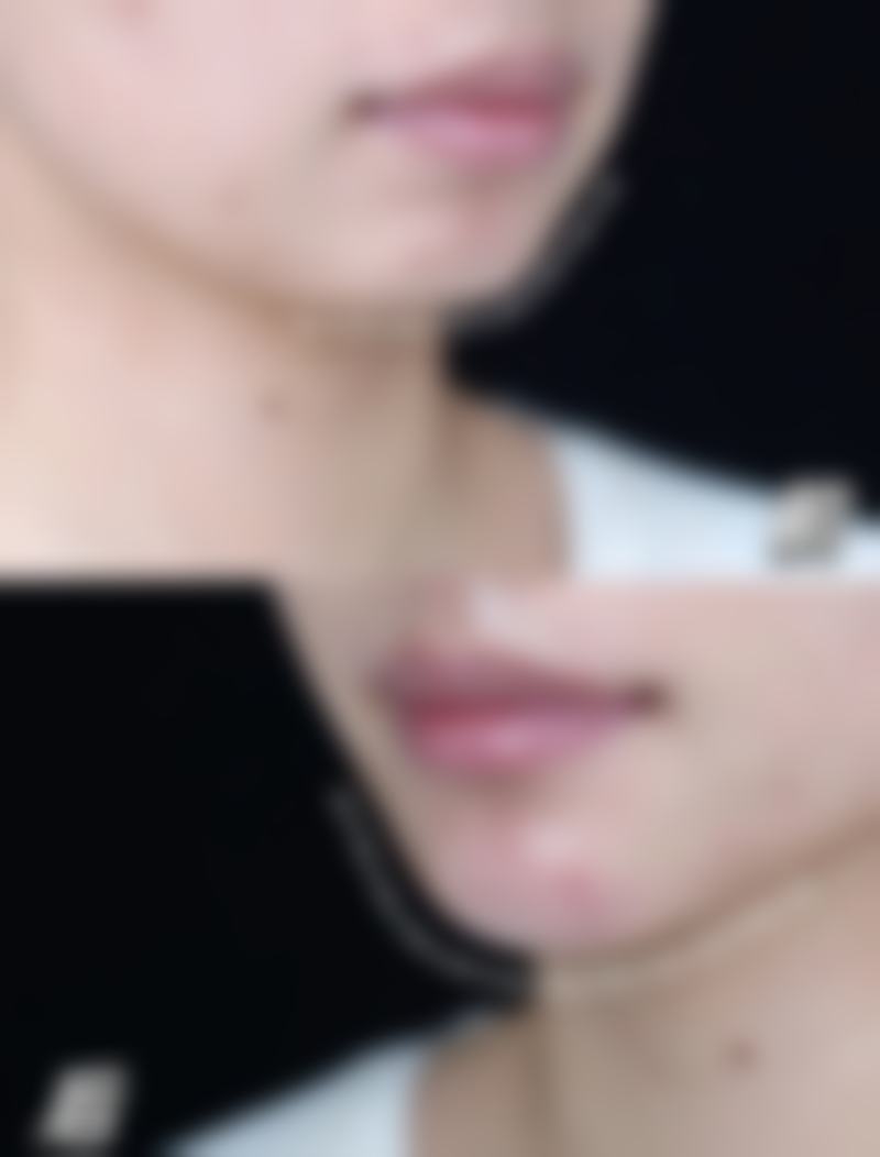 九、长春医 科医院真实的患者评价