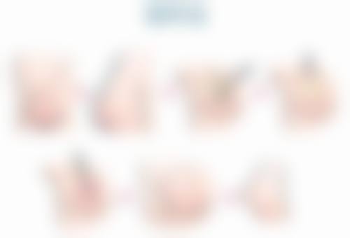 五、假体隆胸能否一辈子不取出