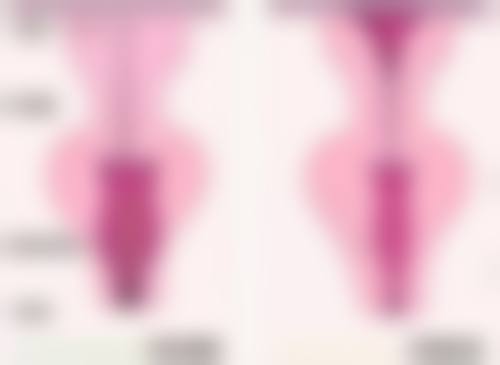 二、疤痕粘连能否自愈的影响因素