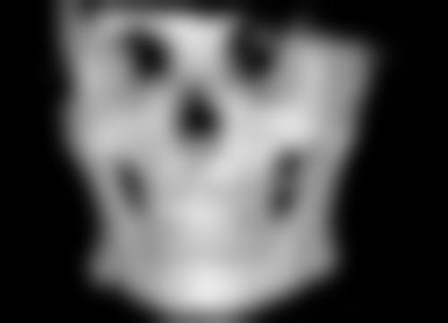 一、隆胸假体基本情况