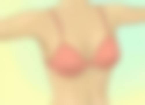 一、脂肪隆胸手术简介