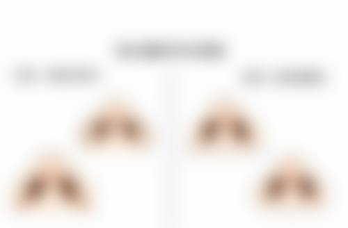 三、打完瘦脸针过敏修复期间的注意事项