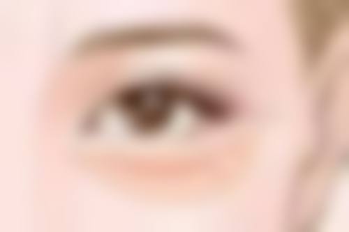 一、打完瘦脸针过敏的症状表现与判断