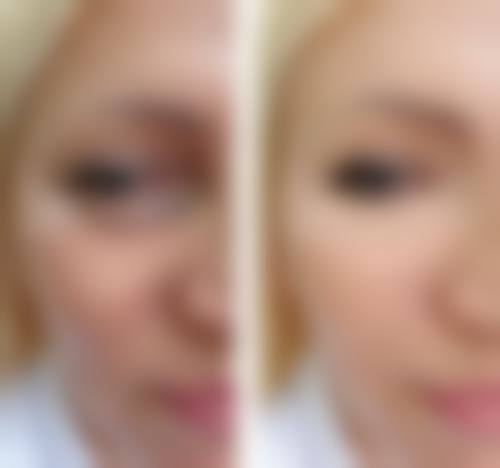 九、长沙罗曼丽黄氏整形医院真实的患者评价