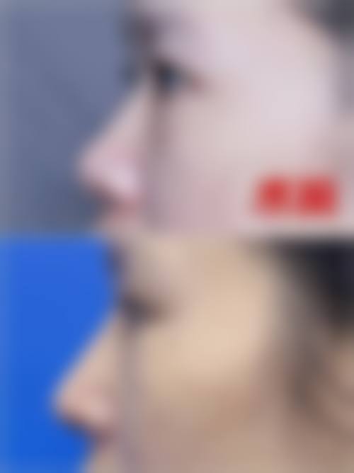 四、中山尼姬医疗整形美容门诊部特色项目