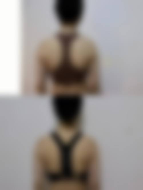 八、北京石榴医疗美容诊所真实的患者评价