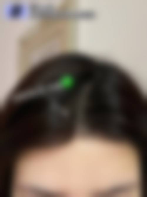 九、北京红旗中医院植发科真实的患者评价