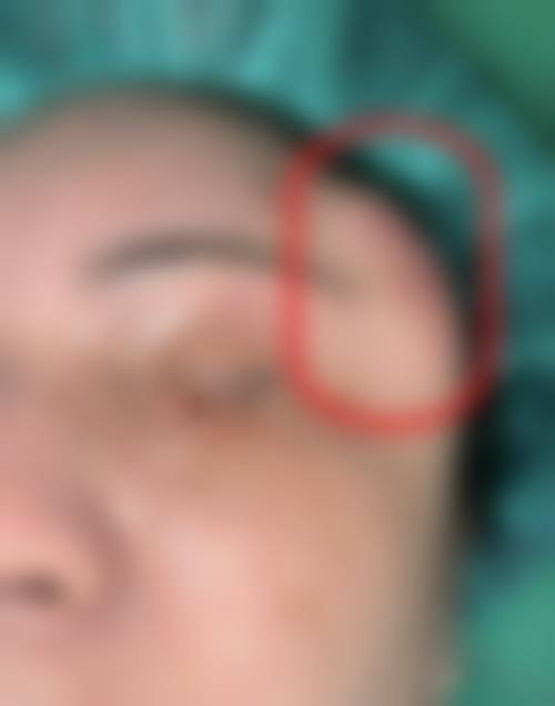 四、昆明涵美医疗美容诊所特色项目