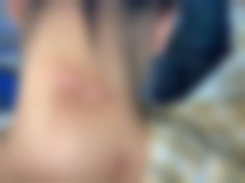 一、合肥星之地整形医院正规吗？