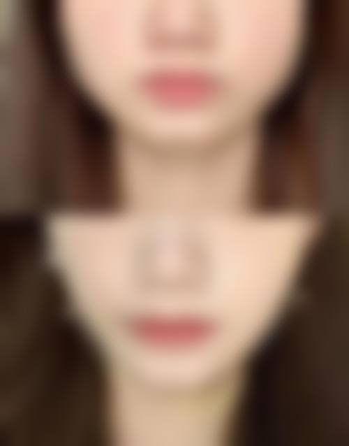 六、昆明涵美医疗美容诊所价格表