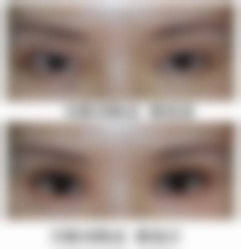 三、西安第四军 医 大学西 京医院整形美容外科研究所诊疗项目有哪些?