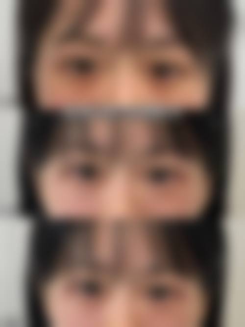 四、珠海普玥医疗美容诊所特色项目