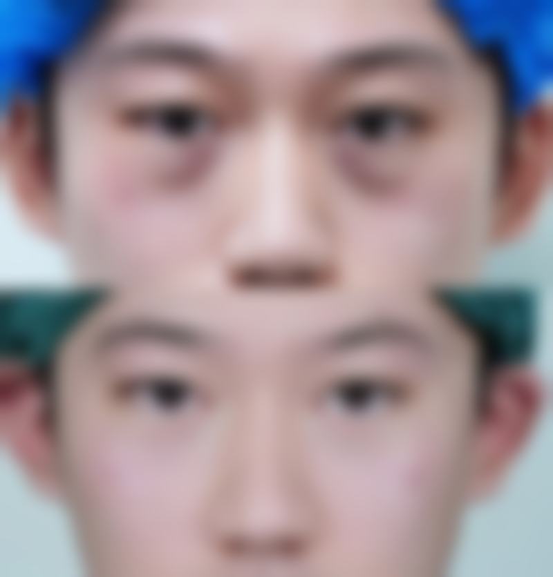 五、牙膏加盐用于眼部可能带来的风险