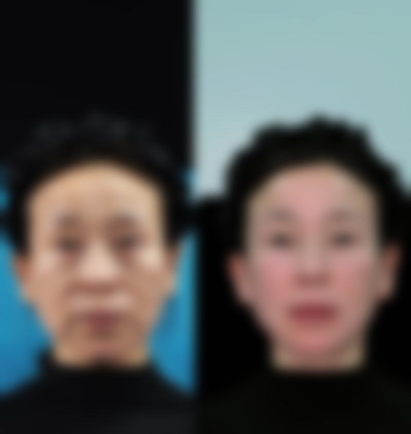 六、唐山市工人医院(医学美容科)价格表