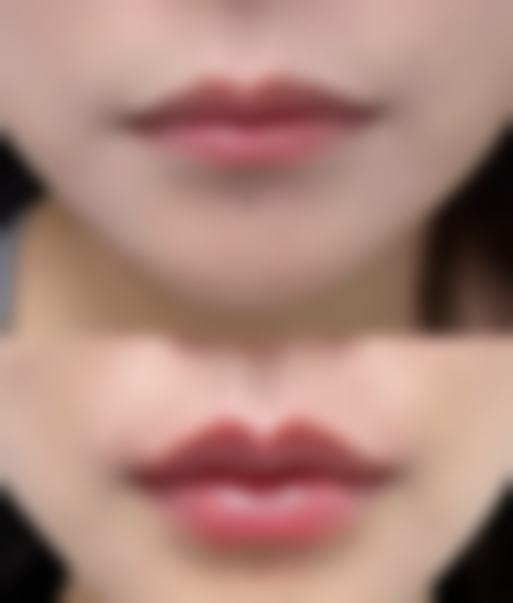 五、邵阳小张医疗整形医院价格表