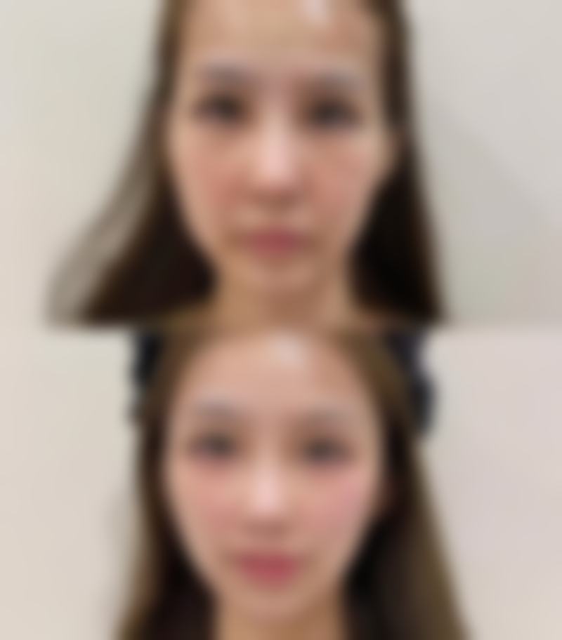 五、深圳小珂丽格医疗整形美容诊所价格表