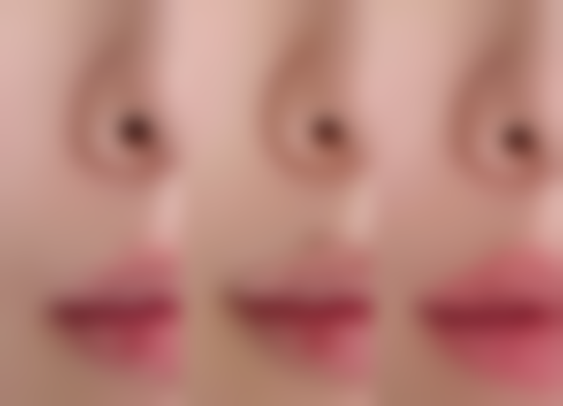 四、打完瘦脸针过敏的原因分析