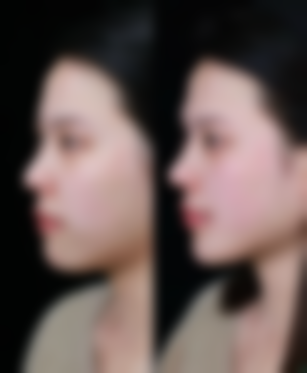 三、邵阳小张医疗整形医院诊疗项目有哪些?