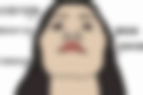 三、选择祛眼袋手术的注意事项