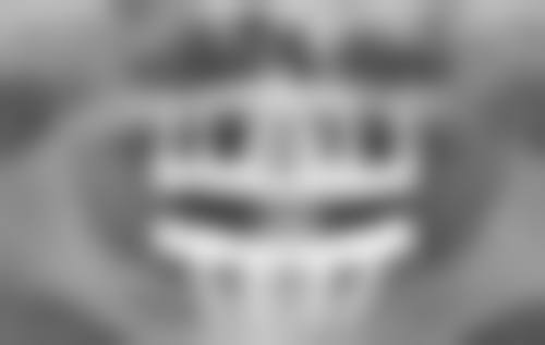 去眼袋黑眼圈怎么去除？掌握这些小妙招，日常护理结合医美让眼周重焕光彩 