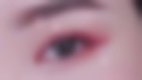 祛眼袋什么手术最好？多种术式大揭秘，助你选对方法告别眼袋烦恼！ 