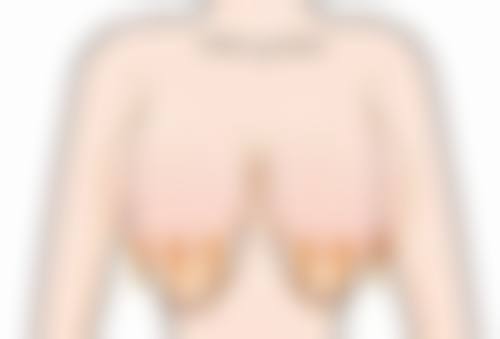 一、去眼袋黑眼圈怎么去除？先了解成因与类型