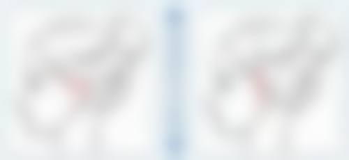 四、去眼袋黑眼圈怎么去除？物理治疗有成效