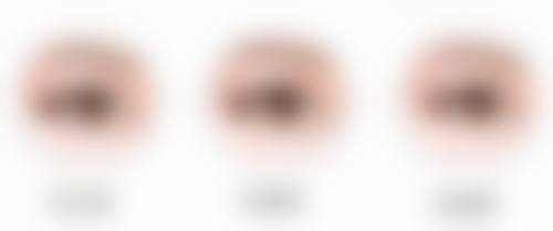 六、去眼袋黑眼圈怎么去除？不同人群有不同需求