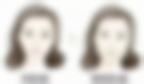 二、常见去除烫伤后红色疤痕药膏对比