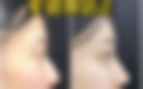 八、三亚刘天顶医学整形诊所真实的患者评价