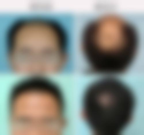 四、Disornvasuntaraporn收费价格表