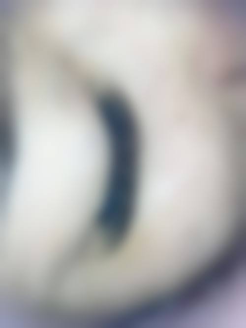 六、ManatchayaJedsadakraisorn真实的患者评价