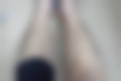 二、三亚刘天顶医学整形诊所怎么样？