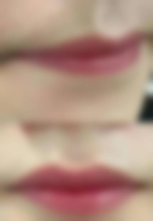 四、海南现代妇婴医院医疗美容科特色项目