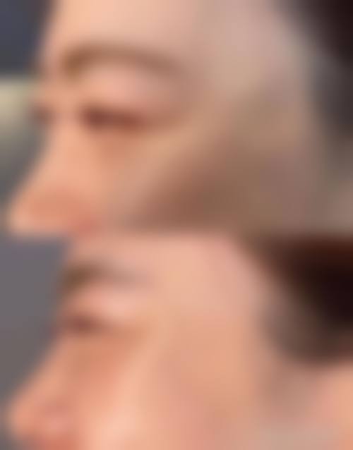 二、西安伊美尔医学美容门诊部怎么样？