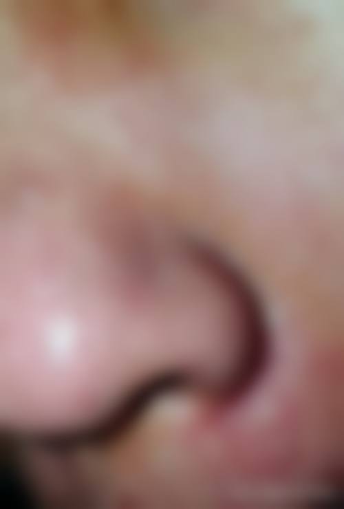 五、三亚刘天顶医学整形诊所价格表