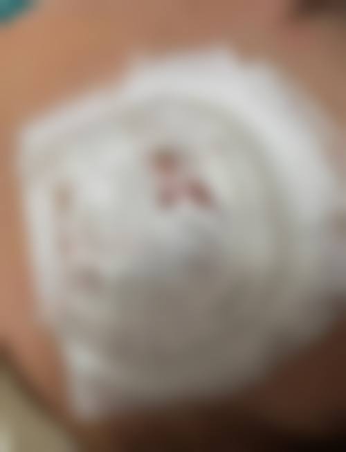 九、中山爱汇星辰整形医院真实的患者评价