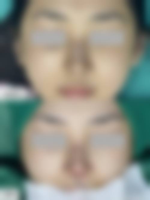 四、信阳奕美整形医院特色项目