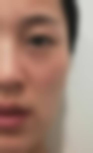 八、武汉颜范医疗美容医院真实的患者评价