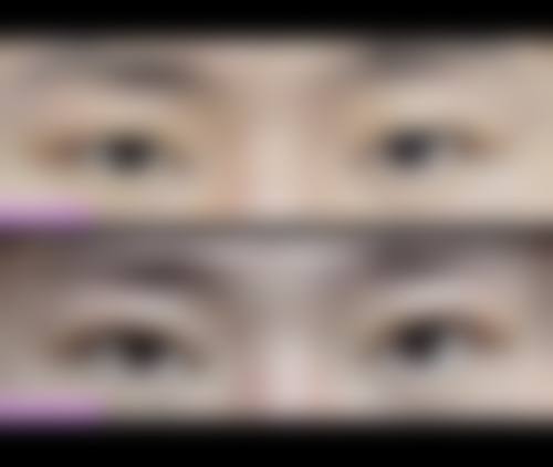 七、信阳奕美整形医院预约方式