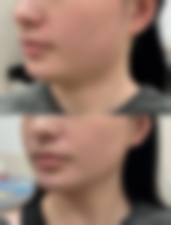 六、西安伊美尔医学美容门诊部价格表