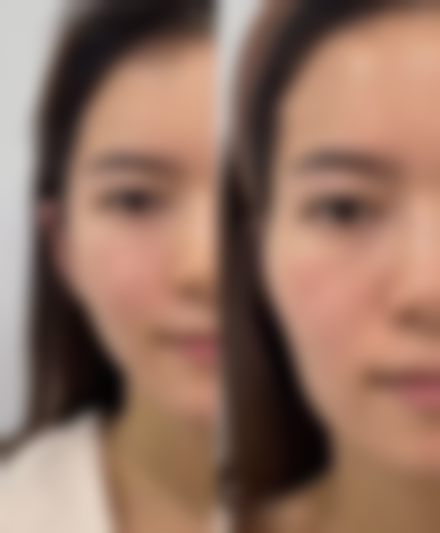 八、西安伊美尔医学美容门诊部预约方式