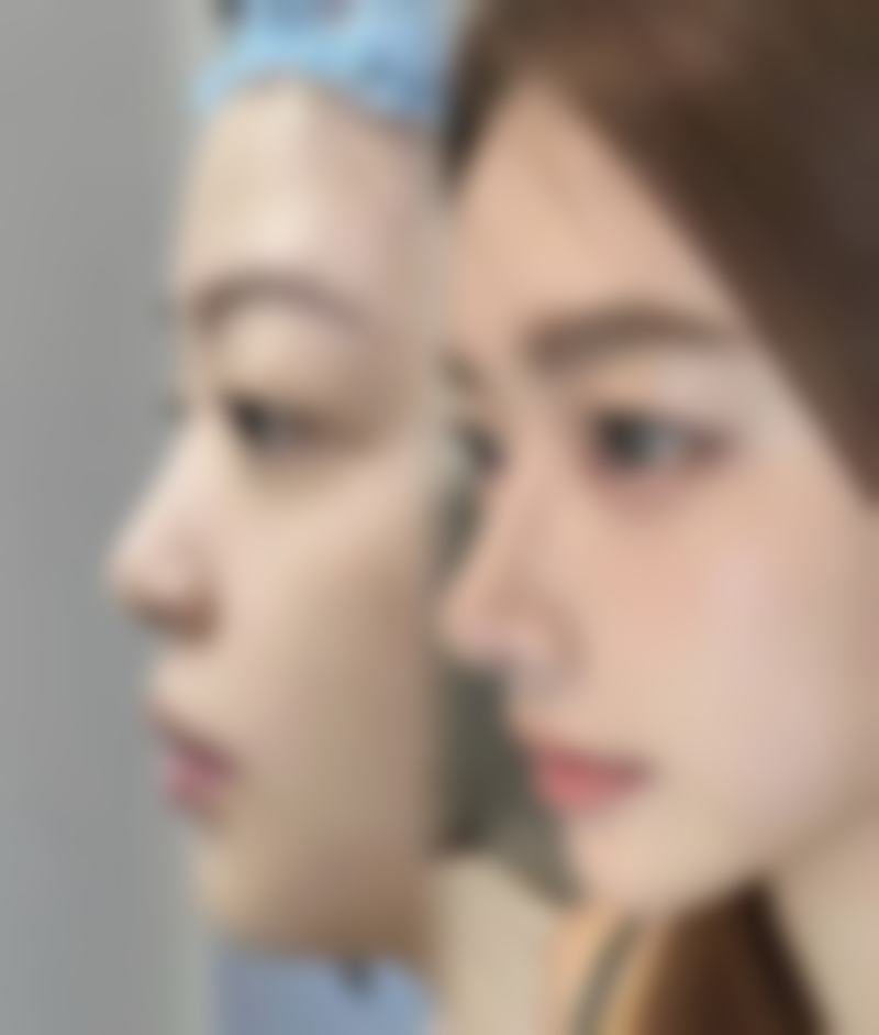 六、韩国美可MAKE整形医院价格表