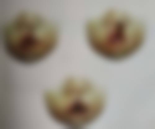 一、生活习惯因素与眼袋突然变黑