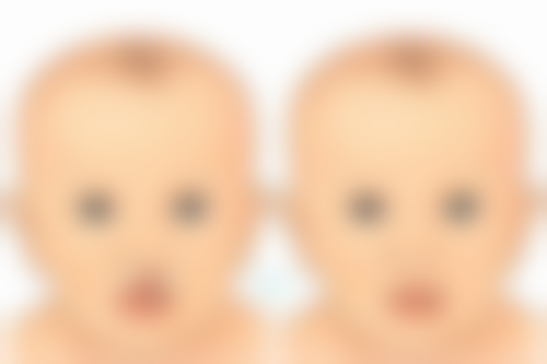 四、肋软骨隆鼻疤痕管理