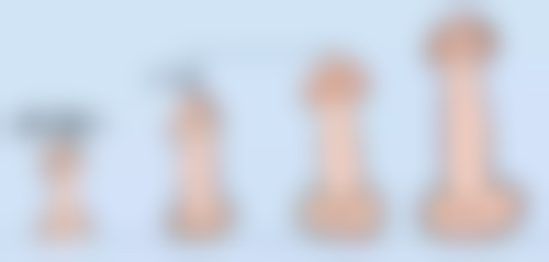 双眼皮后多久可以接睫毛？全切与非全切手术恢复时间大不同，一文讲清！ 