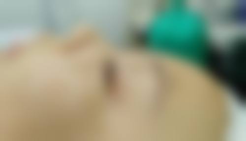 三、什么祛疤膏能助力：具体产品举例