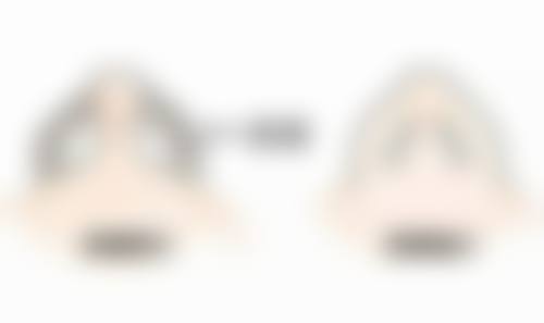 四、外在环境因素与眼袋突然变黑