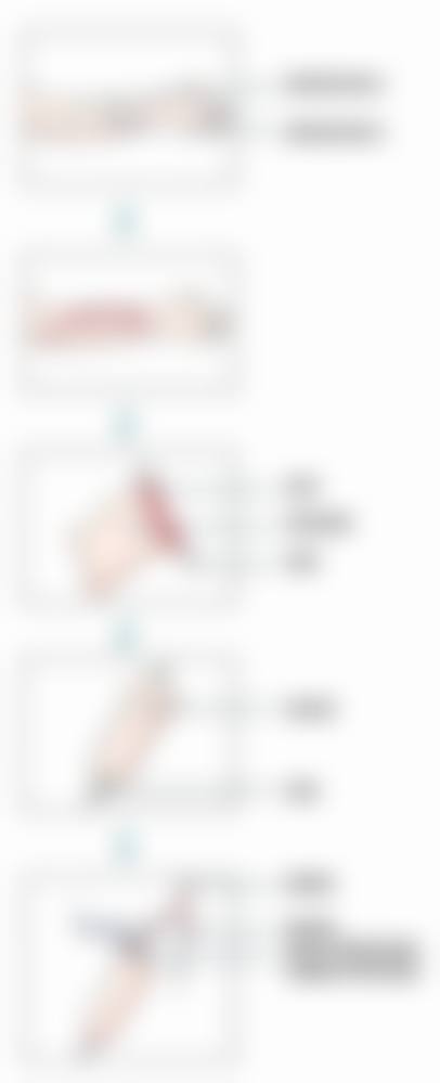 四、青海省人民医院整形美容科特色项目