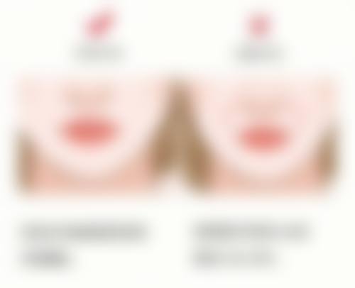 二、肋软骨隆鼻后多久修复:修复阶段大揭秘